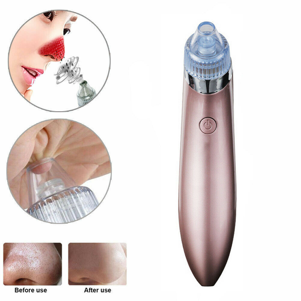 Electric Blackhead Vacuum Pore Cleaner | Rechargeable Pore Vacuum and Skin Exfoliation Tool