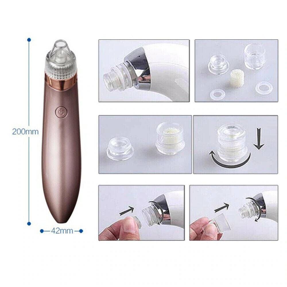 Electric Blackhead Vacuum Pore Cleaner | Rechargeable Pore Vacuum and Skin Exfoliation Tool