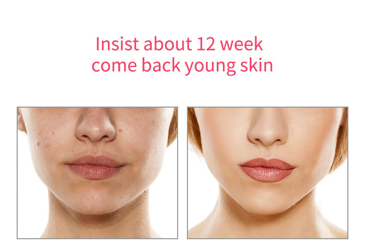 5-in-1 Red and Blue Light Facial Therapy Device | EMS Skin Tightening, Hot & Cool Lifting and Anti-Aging Face Massager for Puffiness and Fine Lines