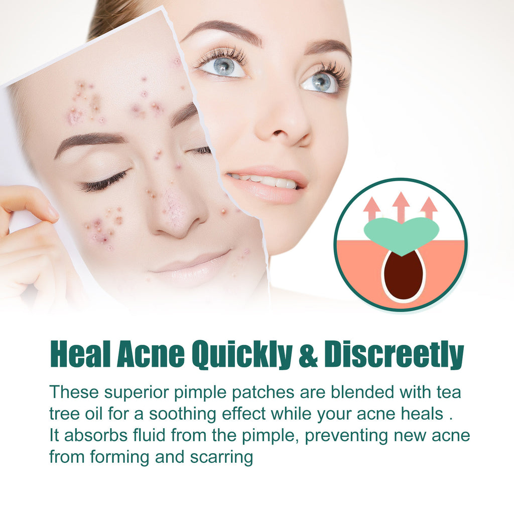Hydrocolloid Acne Patch with Tea Tree and Calendula | Gentle Spot Care for Blemishes and Redness