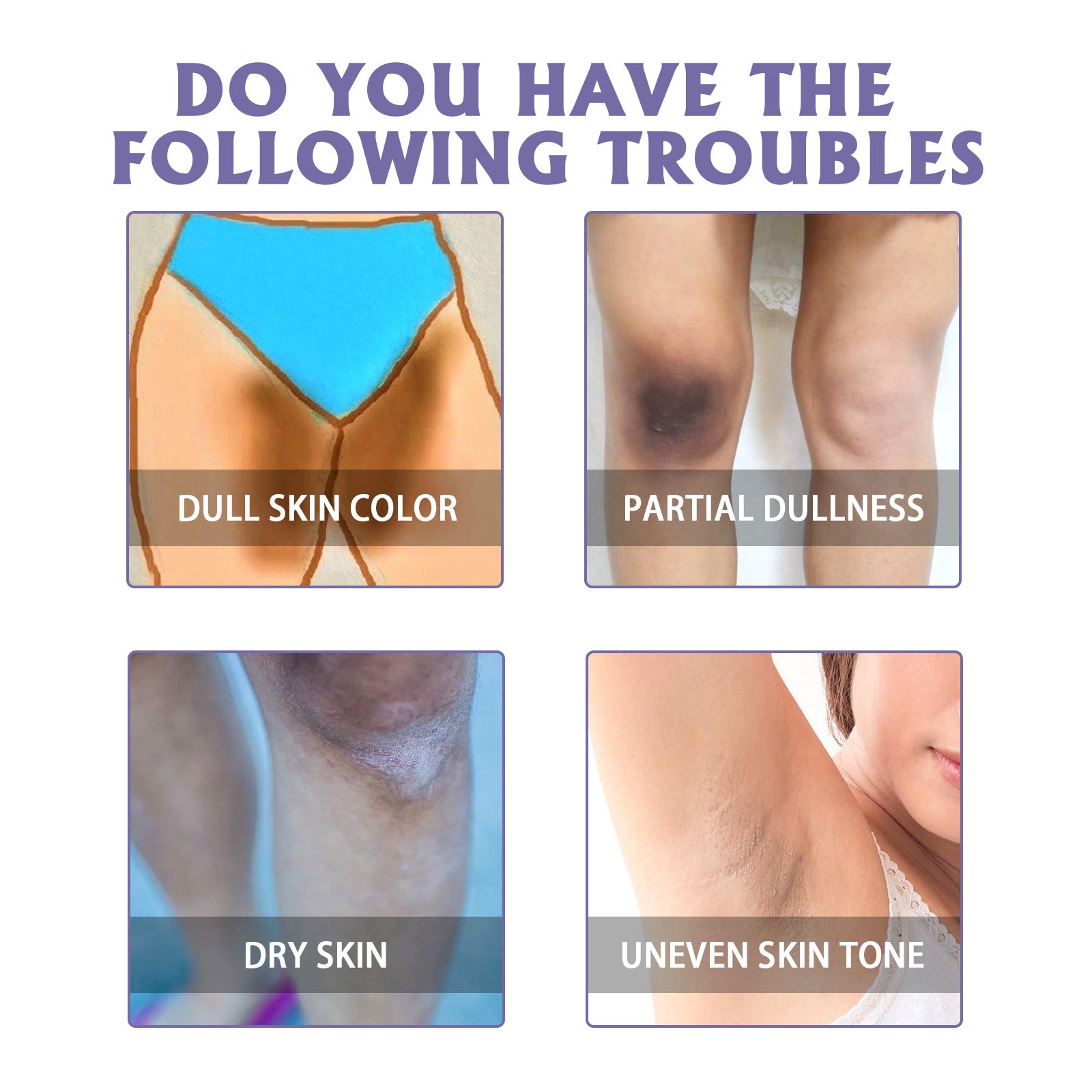 Brightening Body Moisturizer Cream | Hydrating Care for Elbows, Knees, Underarms and Dull Skin Areas