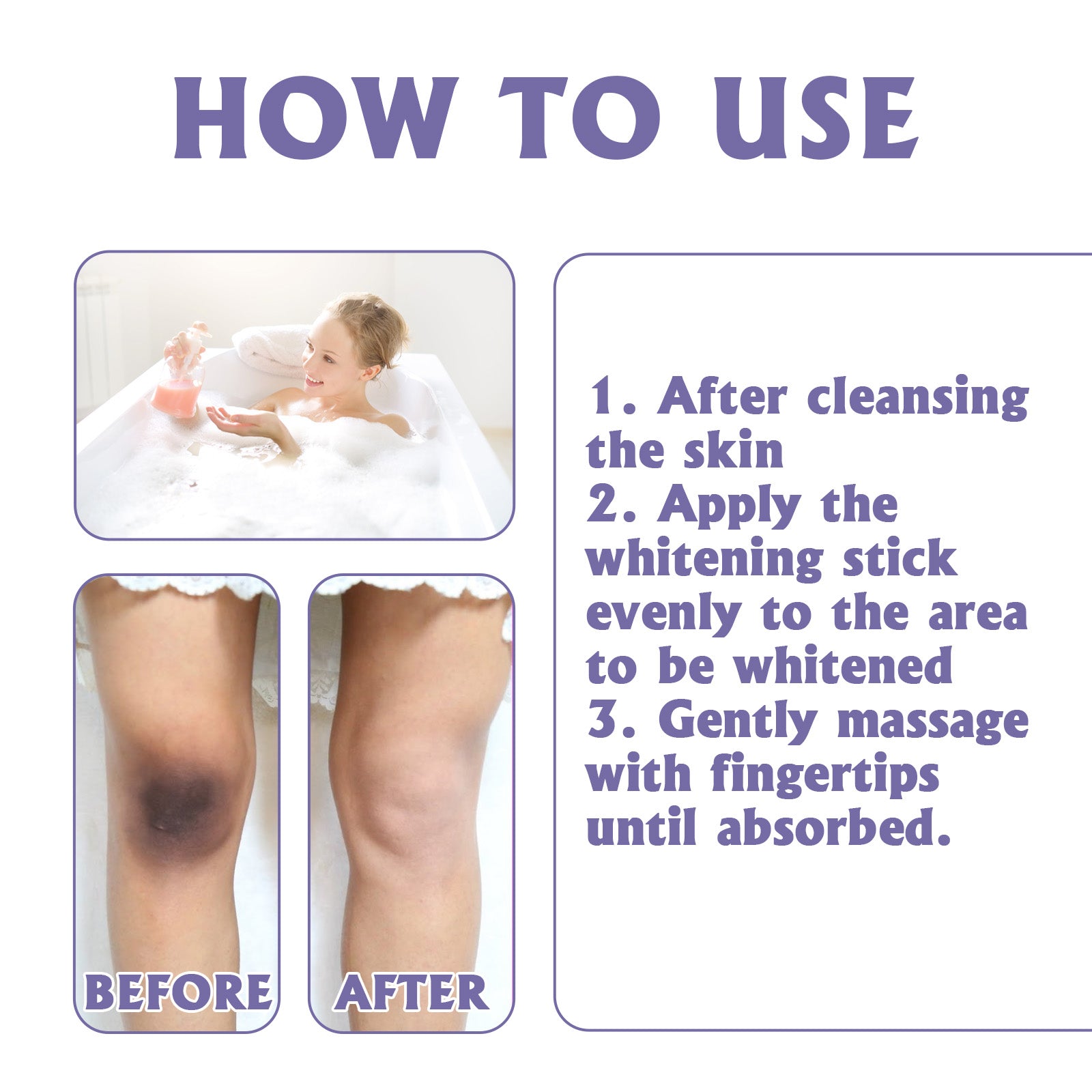 Brightening Body Moisturizer Cream | Hydrating Care for Elbows, Knees, Underarms and Dull Skin Areas