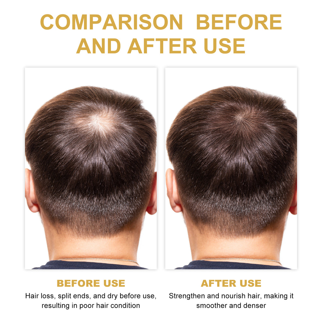 Rosemary Hair Treatment Oil | Nourishing Scalp & Hair Repair Oil with Castor & Argan Oil