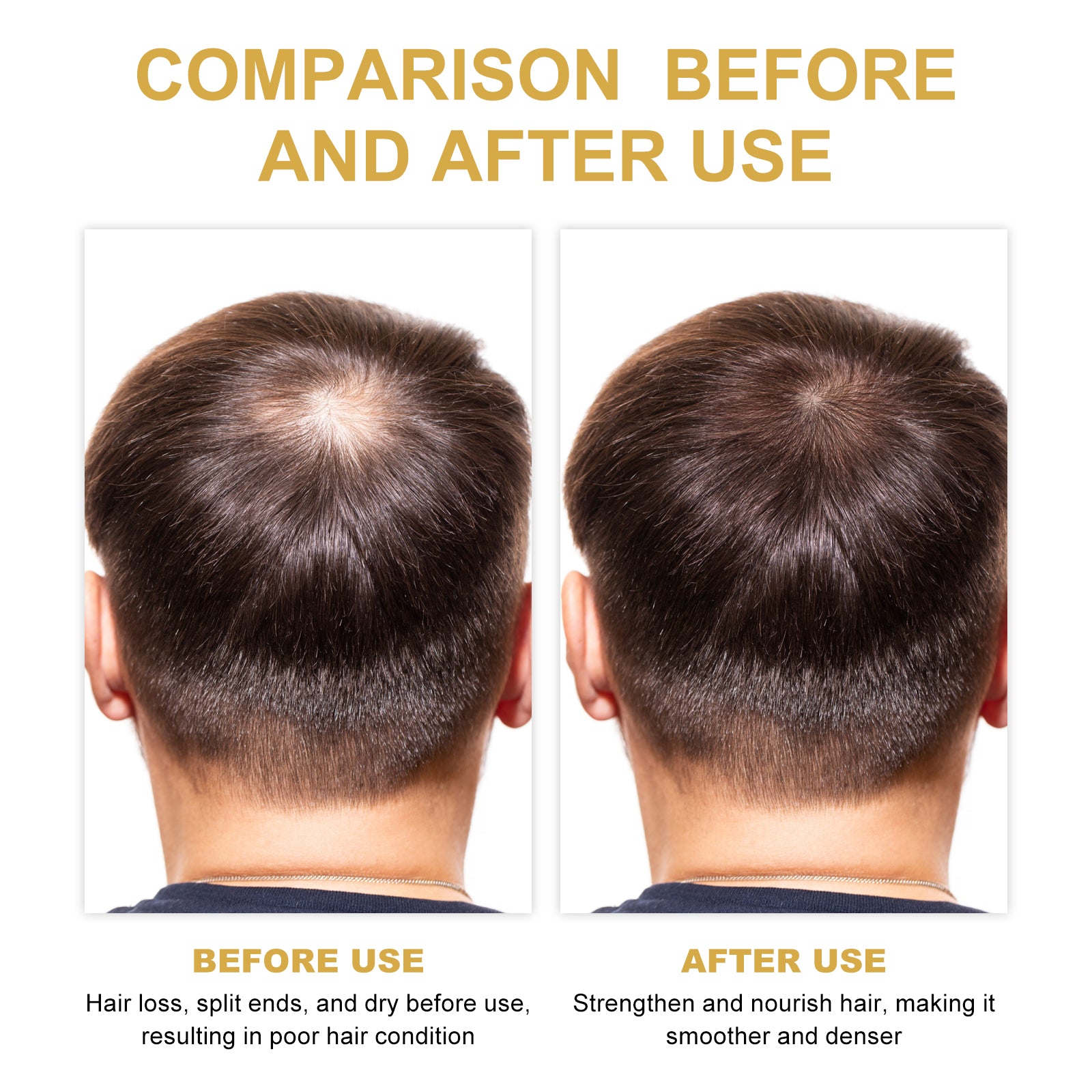 Rosemary Hair Treatment Oil | Nourishing Scalp & Hair Repair Oil with Castor & Argan Oil