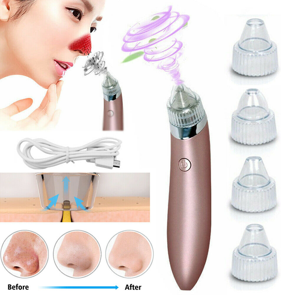 Electric Blackhead Vacuum Pore Cleaner | Rechargeable Pore Vacuum and Skin Exfoliation Tool