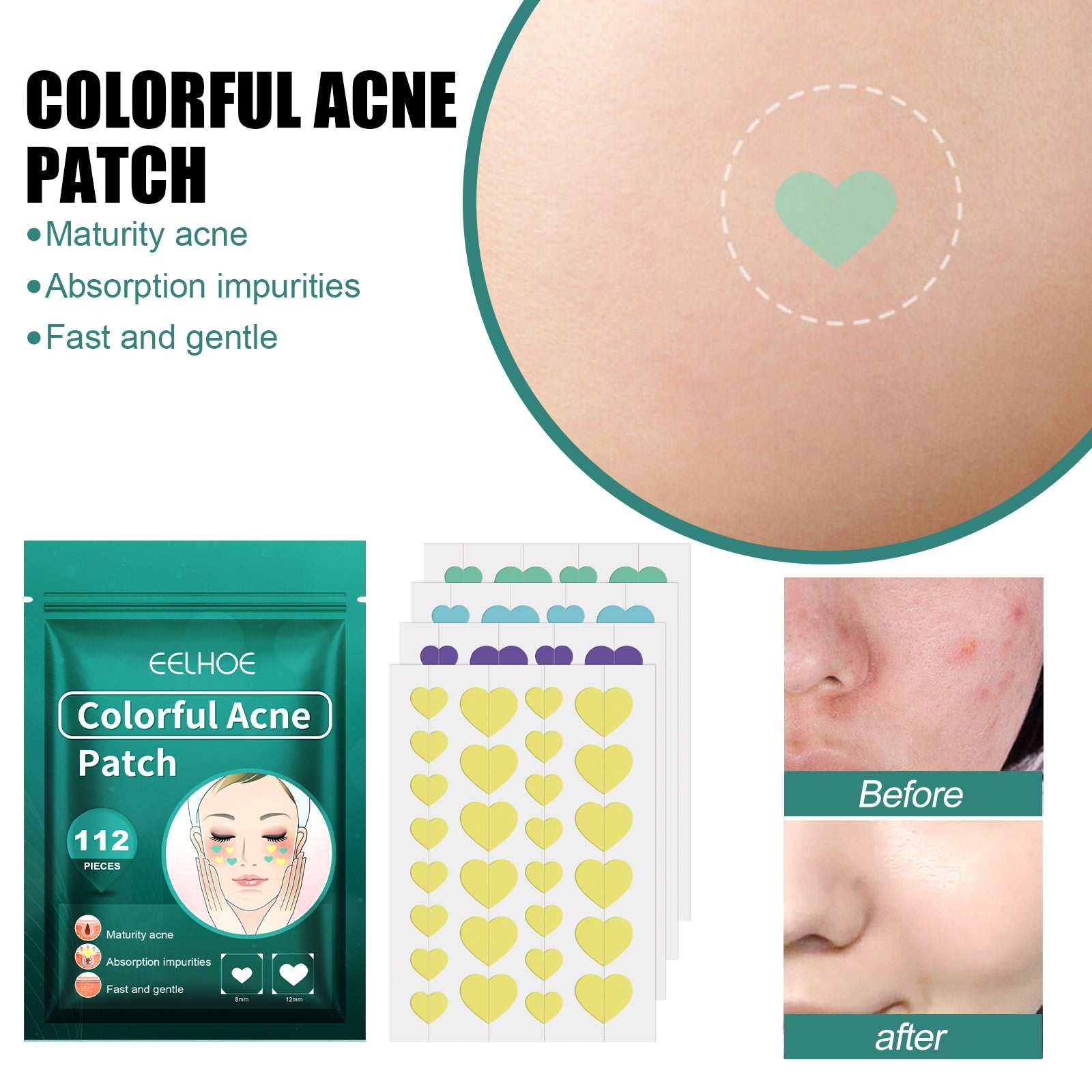 Hydrocolloid Acne Patch with Tea Tree and Calendula | Gentle Spot Care for Blemishes and Redness